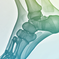 Sport Injuries